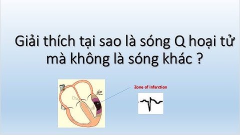 Sóng q hoại tử là gì năm 2024