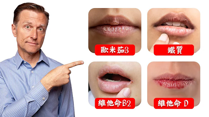 嘴唇缺營養5症狀,礦物油使皮膚更乾燥,柏格醫生 Dr Berg - 天天要聞