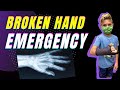 Broken Hand Emergency! || Another Broken Bone 🦴 😢