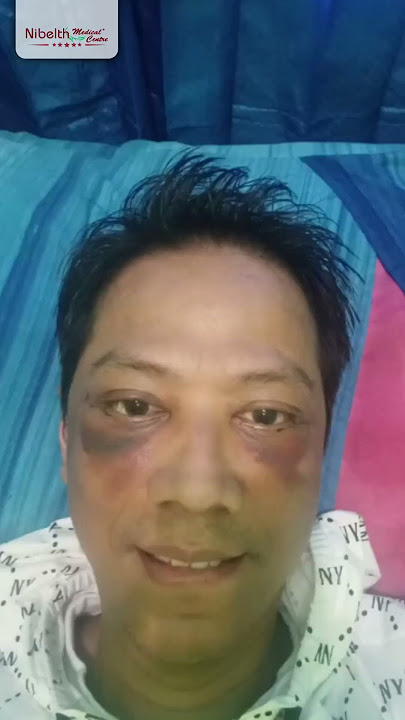 Menghilangkan Kantung Mata di Klinik Nibelth