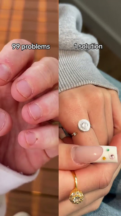 These rings saved my life ❤️‍🩹 link in bio 💍
