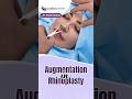 Augmentation In Rhinoplasty, Nose Enhancement Surgery, Best Plastic &amp; Cosmetic Surgeon, Surat.