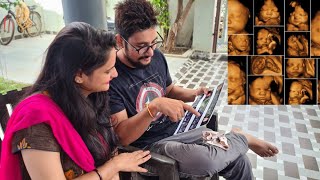 Baby UltraSound me Kitna clear dekh rha hai|| Snappy girls || @THEROTT ||