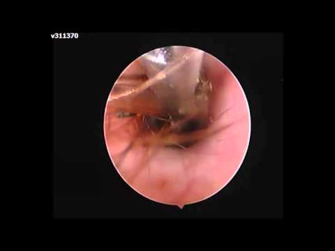 How To Remove Grass Seed From Dog Ear How To Remove Grass Seed From Dog Ear