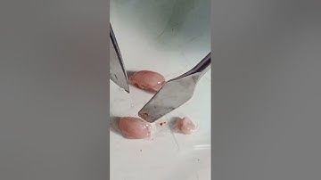 Dissection of mouse hippocampus | Mouse hippocampus dissection | UGM