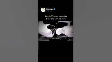 Neuralink Surgery: How the Robot Places 1,024 Electrodes