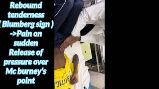 Appendicitis sign for surgery long case prof, in real patient #surgery #longcase #prof #appenicitis