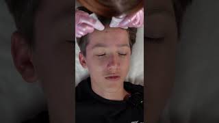 ASMR Pimple Popping