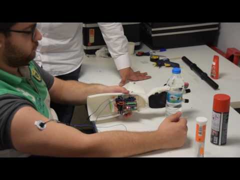 Myoelectric prosthetic hand