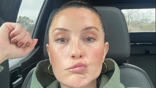 Bristol Palin's Shocking Health Update: 23 Days of Facial Paralysis Revealed!