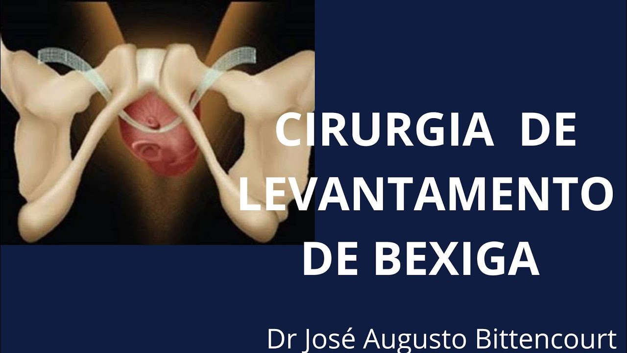 Cirurgia de Levantamento de Bexiga (Sling Vaginal) YouTube