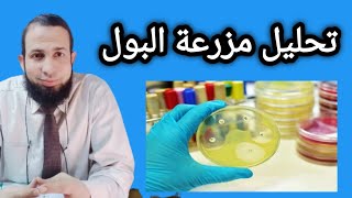 تحليل مزرعة البول الكامل  مزرعة الصديد . Urine culture  #مزرعة