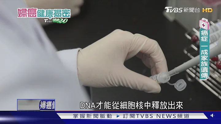 卵巢癌75%病患确诊已晚期 “这些族群做这件事”找致癌基因│妇癌健康揭密 - 天天要闻