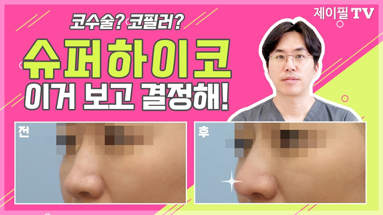 하이코 시술과정 공개! 코수술 코필러 고민하지 마세요