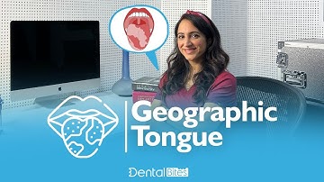 Geographic Tongue