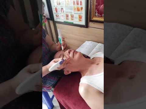 Chữa bệnh ĐAU VAI GÁY bằng phương pháp DIỆN CHẨN không dùng thuốc | Mai An Phế