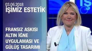 Fransız askısı, altın iğne uygulaması ve gülüş tasarımı - İşimiz Estetik 03.06.2018 Pazar