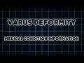 What is a Varus Deformity - YouTube