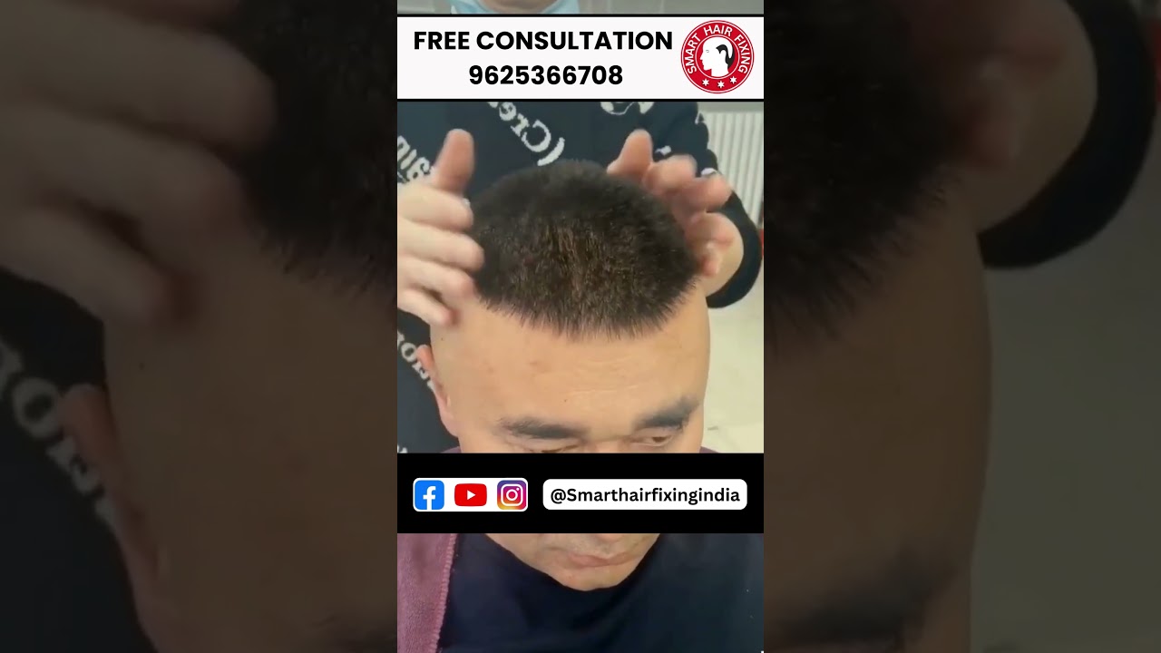 Hair Patch Life – Long Wear, Real Comfort By Smart Hair Fixing !