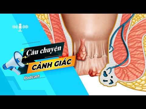 Cẩn trọng với biến chứng của trĩ nội | Câu chuyện cảnh giác || BPTV