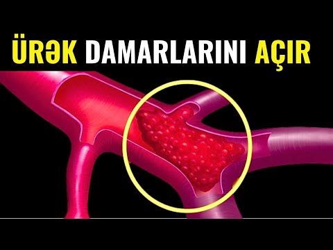 Bu Qida Ürəyə Gedən Damarları 5 Dəqiqəyə Təmizləyir