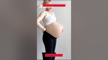Baby kicks from inside the womb #fetalmovement #pregnancyawareness#pregnancytips #pregnancy