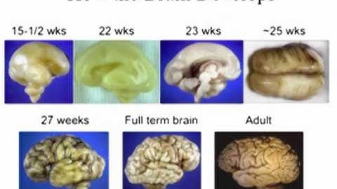 (Part 3/4) The neural basis of ASD