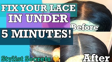 How to FIX your Balding Frontal/ Closure in under 5 Minutes: FAST AND EASY