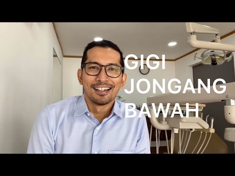 Video: Bilakah Pendakap Diletakkan Pada Rahang Bawah?