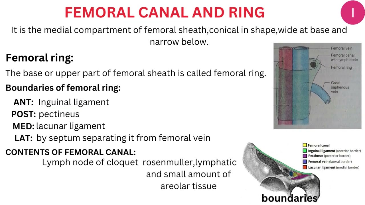 Femoral hernia... - Clinical Anatomy & Operative Surgery | Facebook