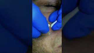 Clean pores never looked better🤤