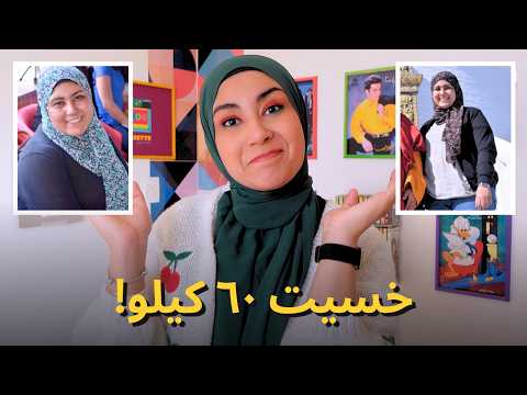 خسيت ٦٠ كيلو 🤯 بعد ٨ سنين .. الحقيقة الكاملة عن عملية التكميم!