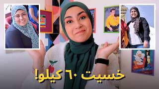خسيت ٦٠ كيلو 🤯 بعد ٨ سنين .. الحقيقة الكاملة عن عملية التكميم!