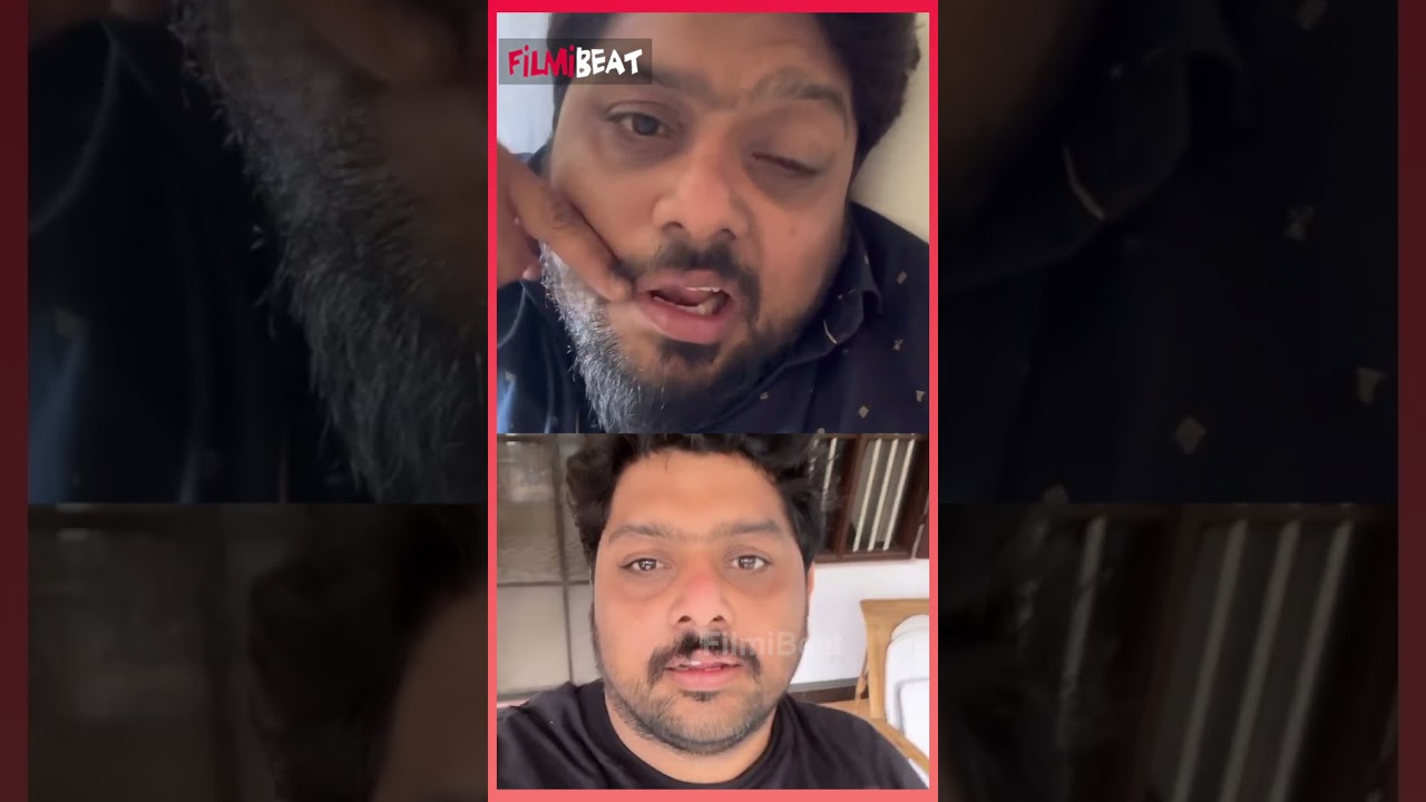 ബെൽസ് പാൾസി യെ തോൽപ്പിച്ച് മിഥുൻ രമേശ്  💪💪| Mithun Ramesh Bell's Palsy