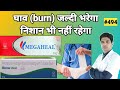 Megaheal cream | Megaheal cream ke fayde | Silver heal cream uses in hindi
