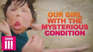 Our Girl With The Rare Condition That Doctors Have Never Seen | Living Differently