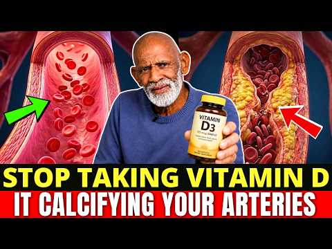 Video Stop the Arterial Calcification Vitamin D Causes — Complete Protocol Inside