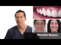 The Cost of Veneers - Why are some cheap and others expensive?