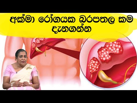 අක්මා රෝගයක බරපතල කම දැනගන්න  | Piyum Vila | 13- 03 - 2020 | Siyatha TV