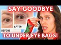 The Eye Cream Pinch Test — Why Your Eye Cream Doesn&#39;t Work