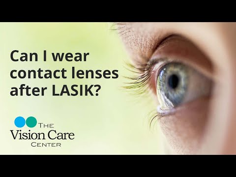 Dr. Tharp Explains: Can I wear contact lenses after LASIK?