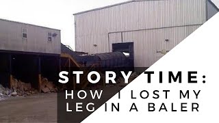 Story Time: How I Lost My Leg | Baler Accident