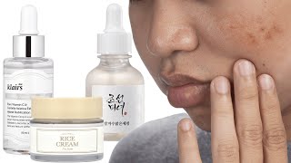 5 Korean Skincare Products to Treat Hyperpigmentation