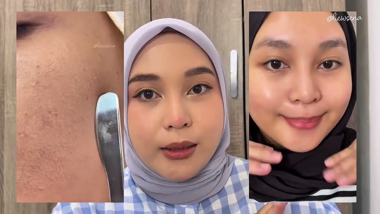 FaceRinna B5 Ceramide Moisturizer