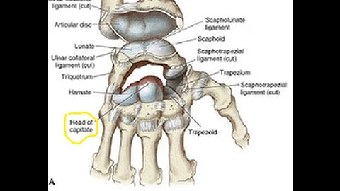 Carpal Instability Part 1  Perry J. Carpenter DC QME   www.ezcontinuingeducation.org