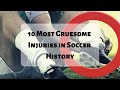 10 Most Gruesome Injuries in Soccer History