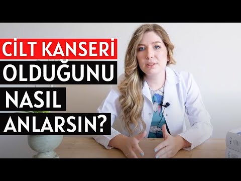 Video: Cilt Kanserinin Erken Belirtilerini Belirlemenin 3 Yolu