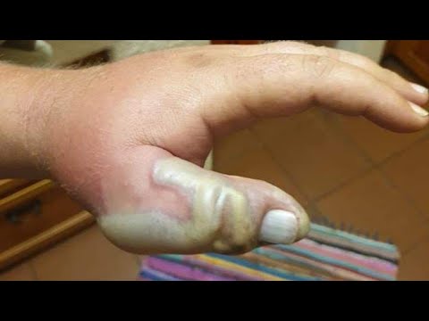 DON T EVER PICK UP SNAKES