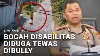 Bocah Disabilitas Diduga Tewas Dibully | Liputan 6
