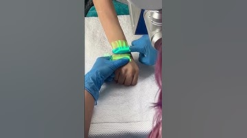 Technology uses infrared light to locate veins in patients